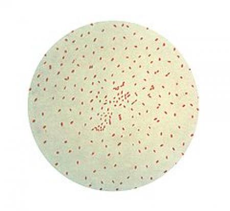  Bordetella Pertussis, el bacteri responsable de la Tos Ferina (imatge de la viquipedia)